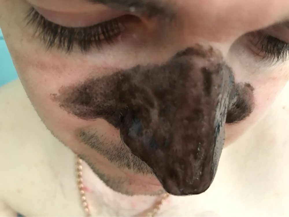 black face mask peel off