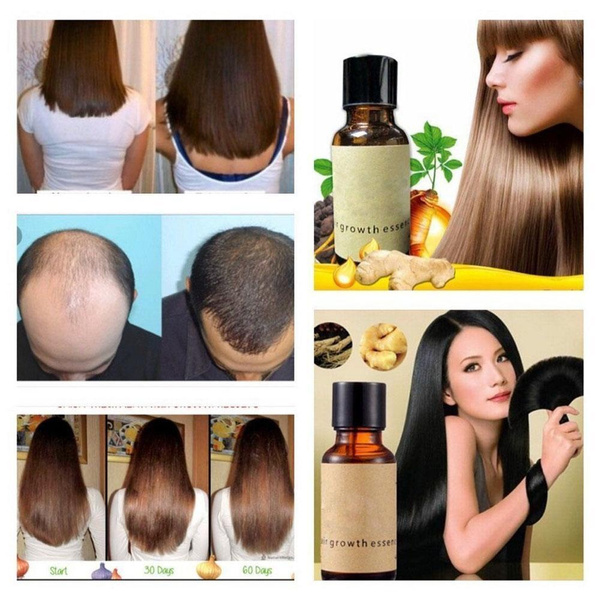 New Fast Hair Growth Products Natural With No Side Effects Anti Hair Loss Serum Grow Hair Faster Wish